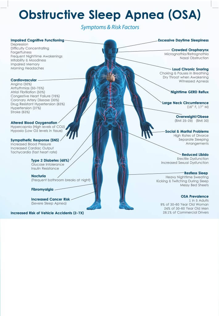 Symptoms of Sleep Apnea